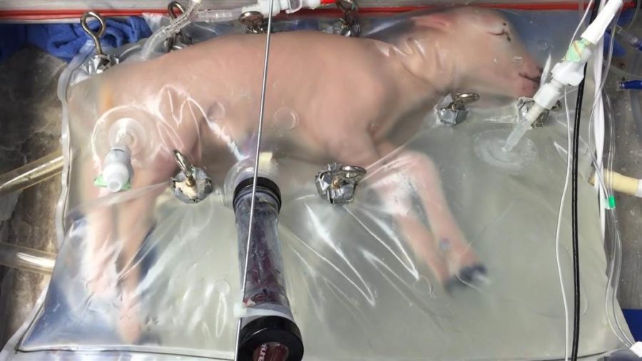 Could Artificial Wombs be the Future?